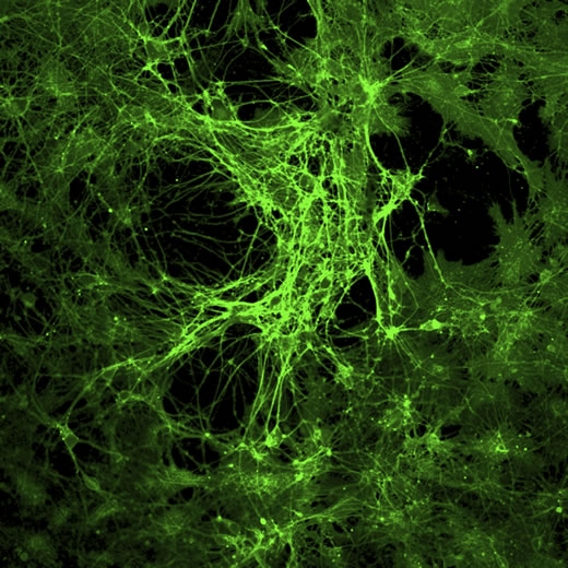 Neuroni pod LSM